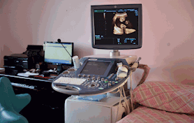 原裝進(jìn)口GEE8彩超