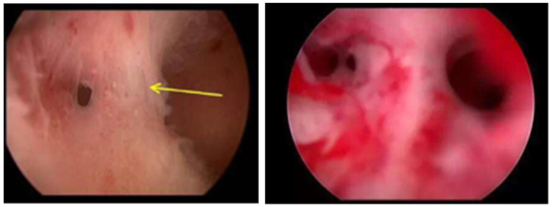 QQ圖片20170828145158.png QQ圖片20170828145158.png