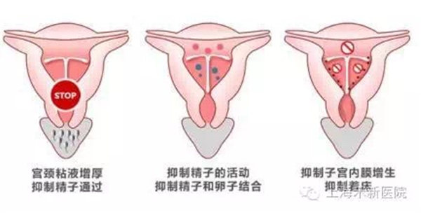 微信圖片_20170705171314.jpg 微信圖片_20170705171314.jpg