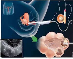 55555555555555555.jpg 55555555555555555.jpg