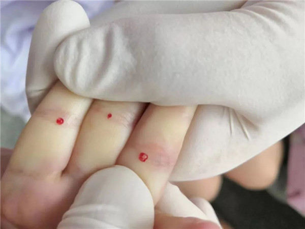 挑治.jpg 挑治.jpg